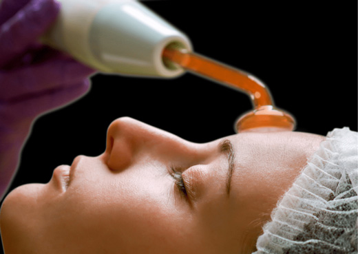 RADIOFRECUENCIA FACIAL