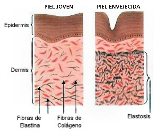 ENVEJECIMIENTO