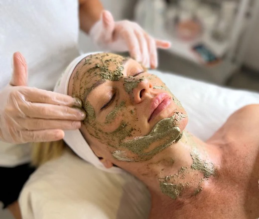 PEELING MARINO
