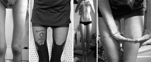 thigh gap