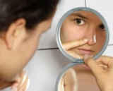 Acn y bacterias: cepas buenas y malas