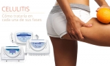 Cmo tratar la celulitis en cada una de sus fases