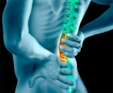 10 preguntas frecuentes sobre lumbalgias