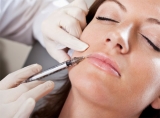Inyecciones de Botox para comisuras bucales