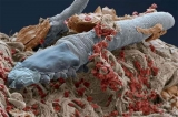 Los caros, esas criaturas microscpicas que viven en nuestra cara