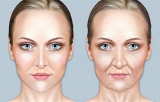 Los cambios faciales que se producen con la edad