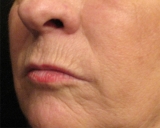 Por qu las mujeres envejecen ms alrededor de los labios que los hombres