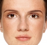 Hiperpigmentacin, una consecuencia del exceso de melanina